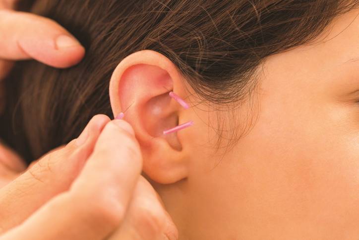 Auricular Acupuncture at Broadway Lodge
